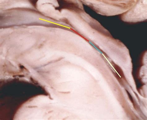 Cerebral aqueduct segments (see text) | Download Scientific Diagram