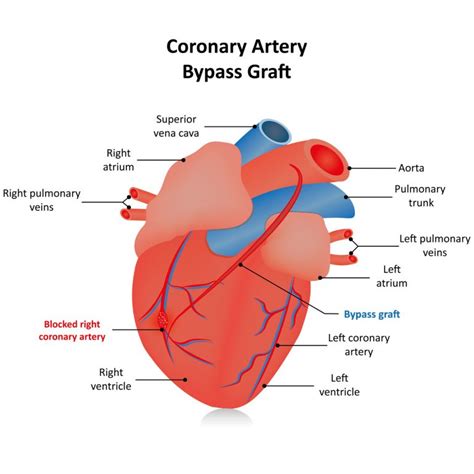 CARDIOLOGY & CARDIAC SURGERY – IJNPRIVATE