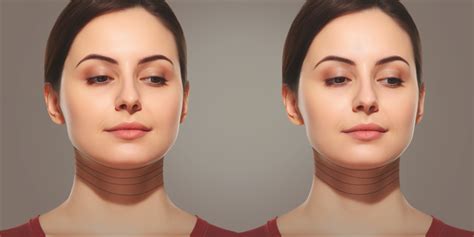 Asymmetrical Chin Surgery Types, Benefits, and Risks - Ruli