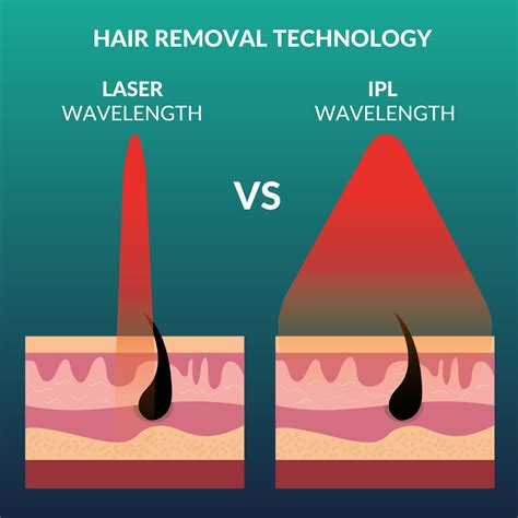 IPL vs Laser Hair Removal: What’s The Difference? | CurrentBody AU | CurrentBody Australia