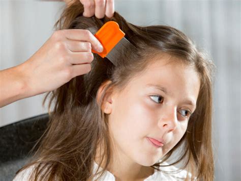 Debunking Lice Myths: What DIY Lice Removal Methods Actually Work? - Scholarly Open Access 2024