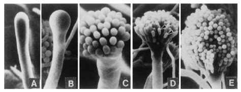 Aspergillus conidia (spores) Spore, Beta, Prime