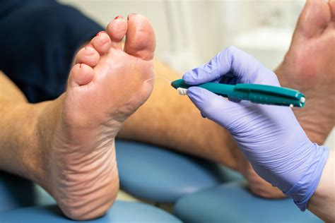 Diabetic Foot Care | Total Foot Health