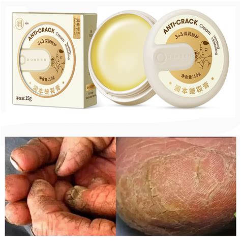 Buy Hand and Foot Repair Cream Cracked Skin Repair Cream, Anti-Crack ...