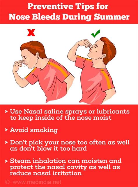 How To Control Nose Bleeds - Clockscheme Spmsoalan