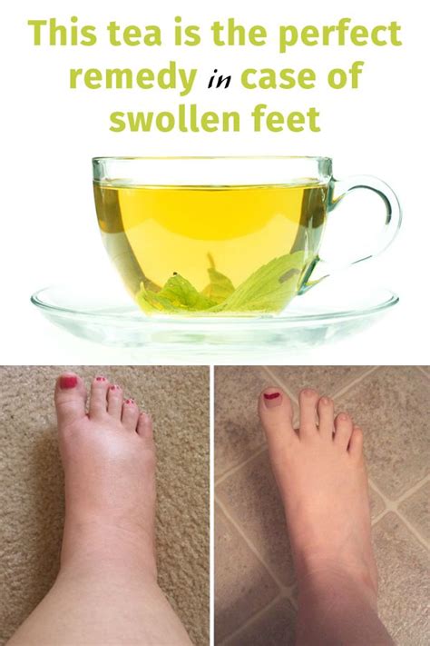 This tea is the perfect remedy in case of swollen feet - Style Idea ...