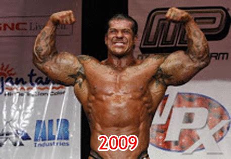 [GIF] Rich Piana is still using Synthol. (exposed) : r/bodybuilding