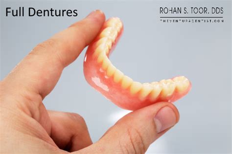 Full Dentures: Process, Problems, Time it takes, Types, Lifespan, Care, Feel, Complete Set ...