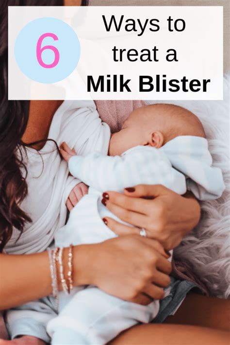 6 Tips To Get Rid Of A Milk Blister (Bleb) | Fit Mommy In Heels