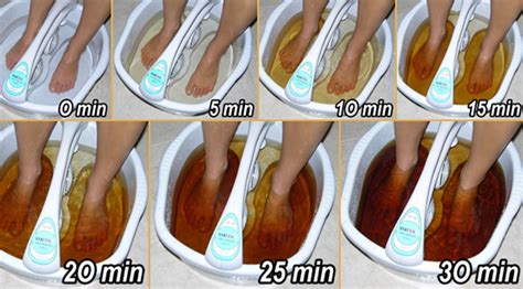 Detox Foot Spa - Ionic Detoxification To Cleanse & Remove Toxins