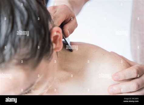 Young Caucasian Woman Getting Body Treatment. Therapist doing skin scrape technique. Chinese ...