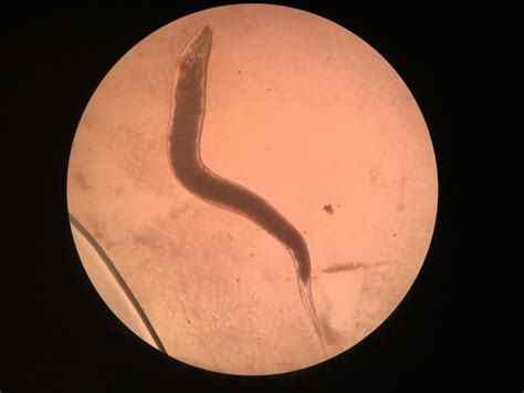 What Does a Worm Look Like Under a Microscope? Tips, Facts, & FAQ - Optics Mag