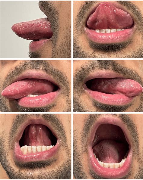 The different movements of the tongue are demonstrated, including ...