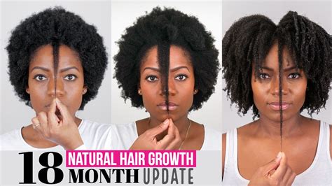 2 Month Hair Growth Sale Shop, Save 43% | jlcatj.gob.mx