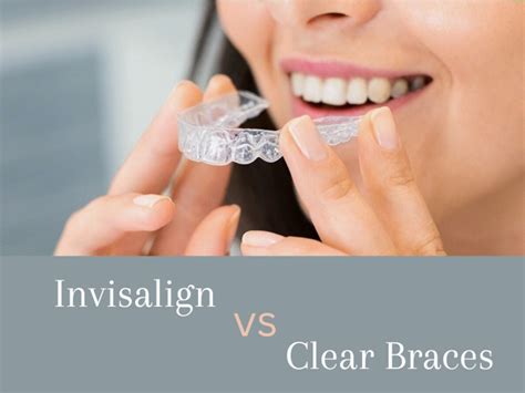 Invisalign vs Clear Braces: Pros and Cons - YouMeMindBody