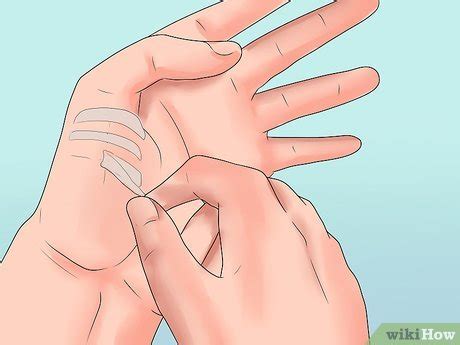 How to Apply Steri Strips: 15 Steps (with Pictures) - wikiHow