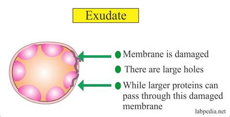 Fluid Analysis – Part 1 – Normal findings, Pleural, Pericardial, and ascites, Difference of ...