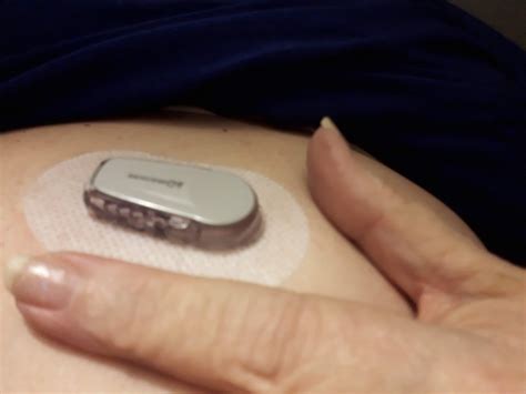 Welcome to Simple: Me and My Dexcom g6