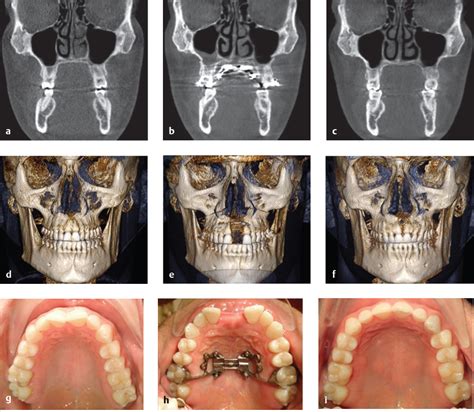 8 Surgery in Adults | Ento Key