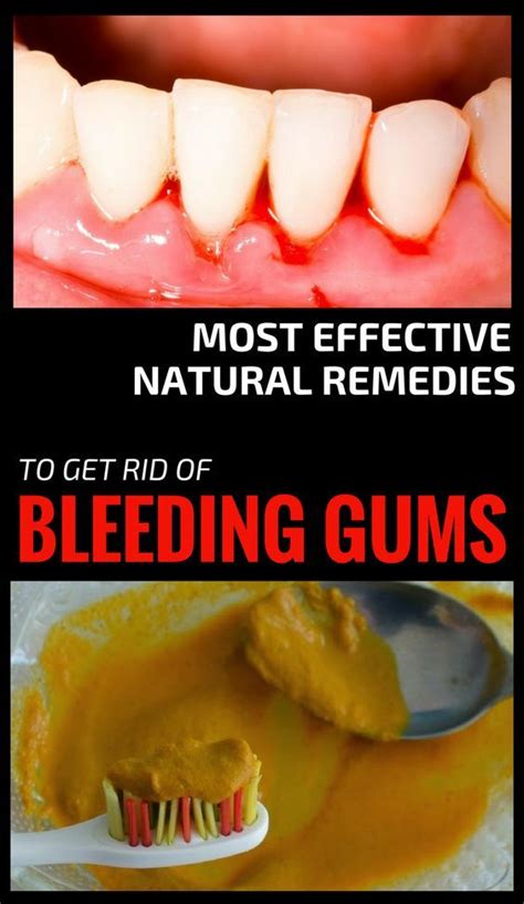 Home Remedies For Gum Infection In Dogs | Home and Garden Reference