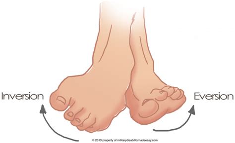 Ankle Sprain - Physiopedia