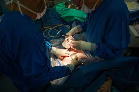 Doctors Performing A Csection On A Pregnat Mother During The Miracle Of Child Birth Stock Photo ...