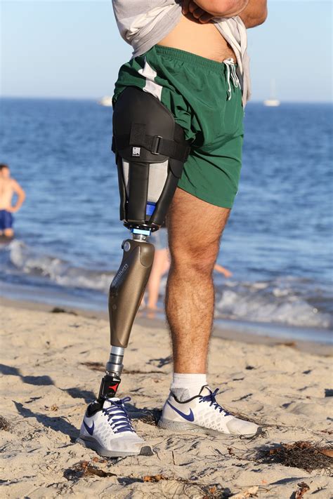 Transtibial prosthesis prosthetic orthotic associates – Artofit