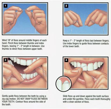 7 Things Flossing Helps Prevent | Dentist in Monroe NC