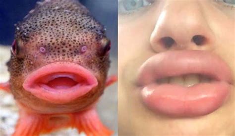 The Kylie Jenner Lip Challenge Continues To Give Girls Fish Lips (14 pics)