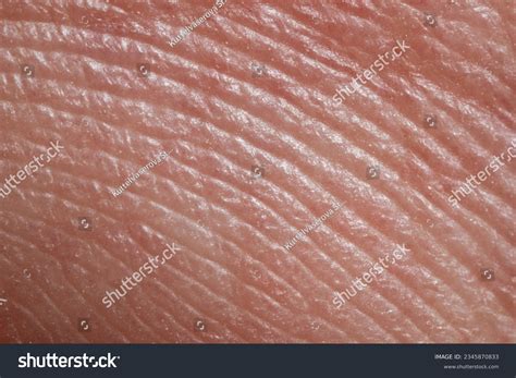 Skin Diseases Concept Macrophotograph Human Skin Stock Photo 2345870833 ...