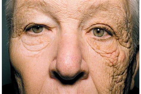 This photo shows what 28 years of sun damage does to your face | The ...