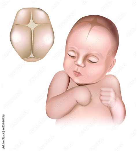 An illustration of a realistic babys head showing the fontanelles ...