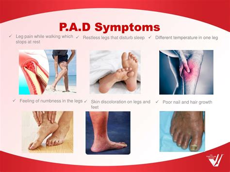 PPT - Facts About Peripheral Artery Disease (P.A.D) PowerPoint ...