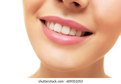 Teeth Before After Care Therapy Whitening Stock Photo 738787807 | Shutterstock