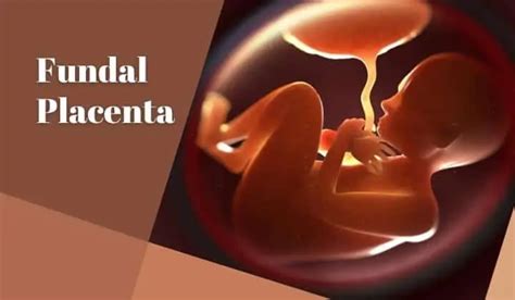 Fundal Placenta: Does Placenta on Top Make Pregnancy Difficult? - ParentingNMore