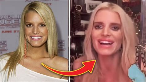 Jessica Simpson's Face Looks WILDY Different: WEIGHT LOSS or Plastic Surgery? - YouTube