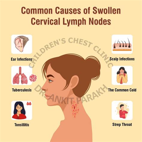 What Causes Mandibular Lymph Nodes To Swell Types Of - vrogue.co