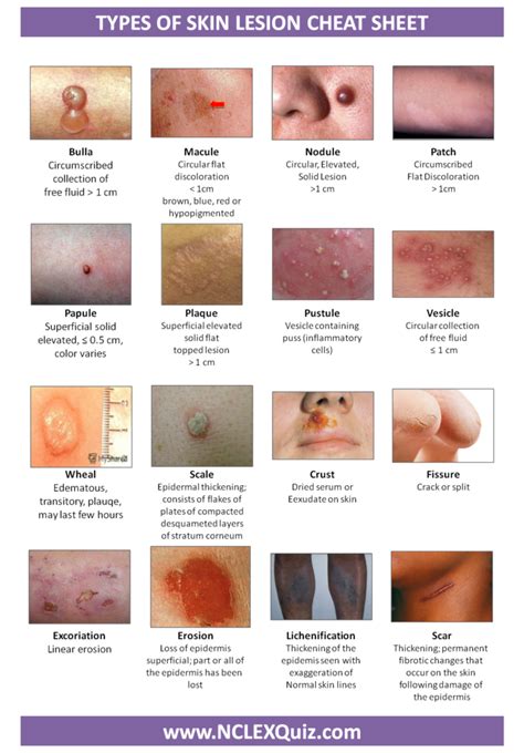 Types of Skin Lesion Cheat Sheet | Pediatric nursing, Nurse practitioner school, Nursing school ...