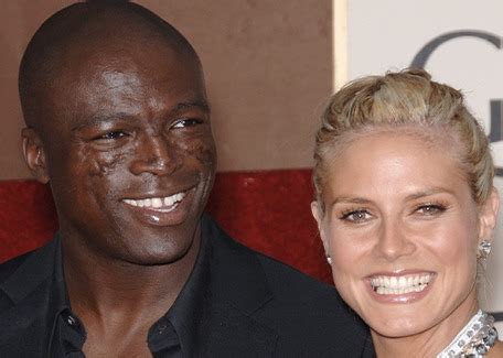 Seal’s had his trademark face scars for more than 30 years – this is ...