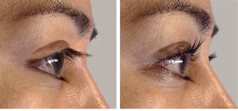 eyelash-perming-before-and-after | Total Body Spa