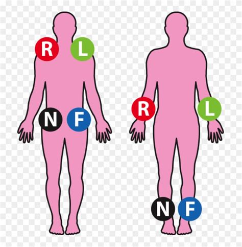 Augmented Leads Placement Chart - Ecg Limb Lead Placement - Free ...