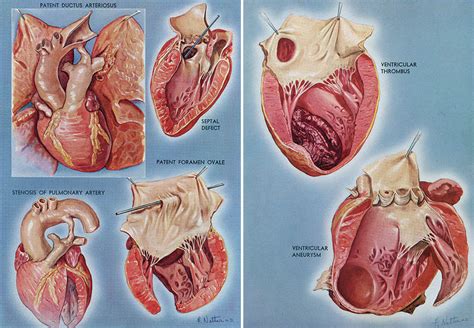 Atlas of Human Anatomy second edition Frank H Netter MD Novartis/Netter Anatomy book/Human ...
