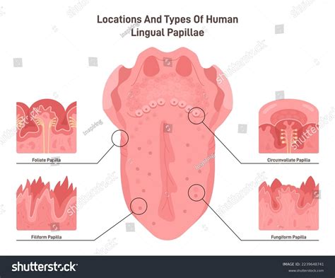 Normal Foliate Papillae