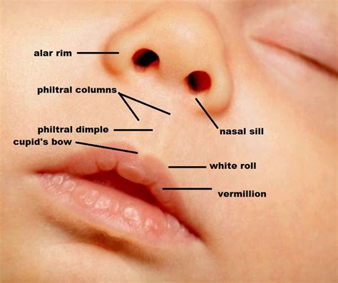 Types de fentes labiales et traitements