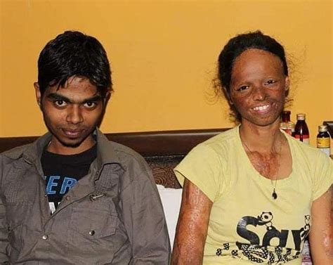 Laxmi Agarwal: The fighter whose life changed after an acid attack