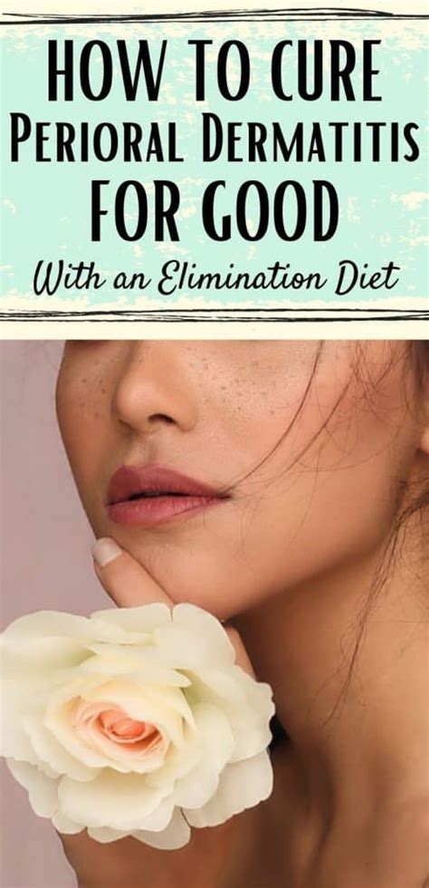 This Diet Cures Your Perioral Dermatitis Face Rash - Shapely Ways