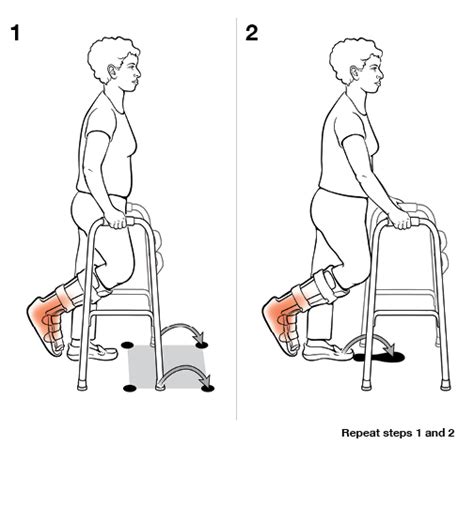 Step-by-Step: Using a Walker (Non-Weight Bearing)