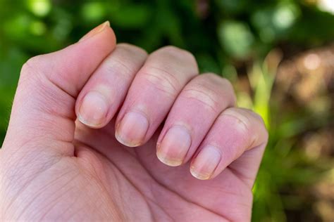 Top 138+ acrylic on natural nails damage super hot - ceg.edu.vn