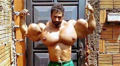 Synthol User Looks Like A Sideshow