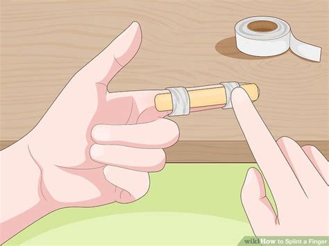 3 Ways to Splint a Finger - wikiHow | Handtherapie